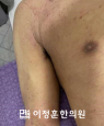경과사진