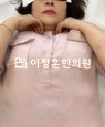 경과사진