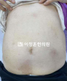 경과사진