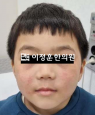 경과사진