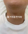 경과사진
