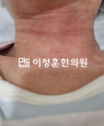 경과사진