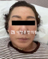 경과사진