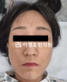경과사진