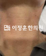 경과사진