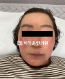 경과사진