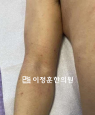 경과사진