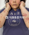 경과사진