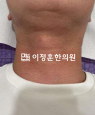 경과사진
