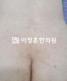 경과사진