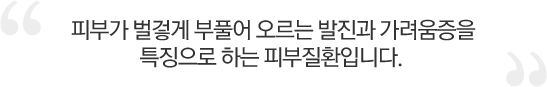 피부가 벌겋게 부풀어오른는 발진과 가려움증을 특징으로 하는 피부질환입니다.