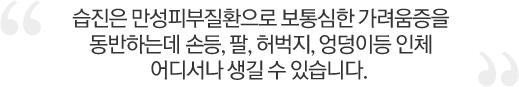 습진은 만성피부질환으로 보통 심한 가려움증을 동반하는데 손등, 팔, 허벅지, 엉덩이등 인체 어디서나 생길 수 있습니다.